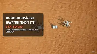 Balık Avı Kabusa Döndü: Bacak Enfeksiyonu Hayatını Tehdit Etti, 8 Kat Büyüdü