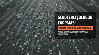 Gazeteci Murat Yetkin'e Scooterlı Çocuk Çarptı: Ayak Kemikleri Kırıldı