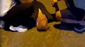 Aydın'da Çıkan Kavgada Bir Kişi Başından Yaralandı