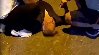 Aydın'da Çıkan Kavgada Bir Kişi Başından Yaralandı