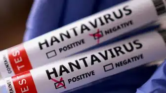 Hantavirüs Türkiye'ye Geldi mi? Sağlık Bakanlığı Açıklama Yaptı