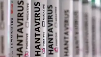 MV Hondius Gemisinde Hantavirüs Salgını: 300 Numune Kaybı 3 Can Aldı