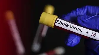 Uganda, Ebola Endişesiyle Kongo Sınırını Kapattı