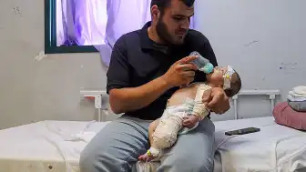 İsrail Saldırısında Annesini Kaybeden Bebek Muhammed'in Bacağı Ampute Edildi