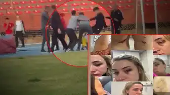 Zonguldak'ta Eski Eşine Şiddet Uygulayan Kişiye Kardeşi ve Arkadaşları Tarafından Saldırı