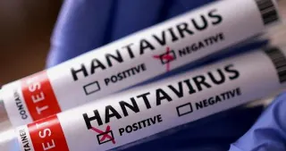Hantavirüs Türkiye'ye Geldi mi? Sağlık Bakanlığı Açıklama Yaptı