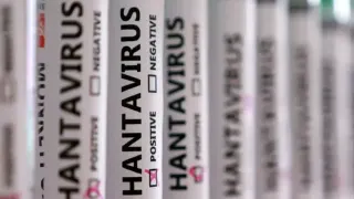 MV Hondius Gemisinde Hantavirüs Salgını: 300 Numune Kaybı 3 Can Aldı